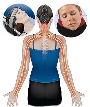 Cervical-Radiculopathy-Pain-Symptoms-Treatment