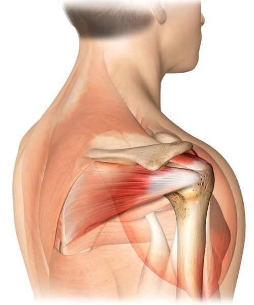 3 Signs of a Frozen Shoulder